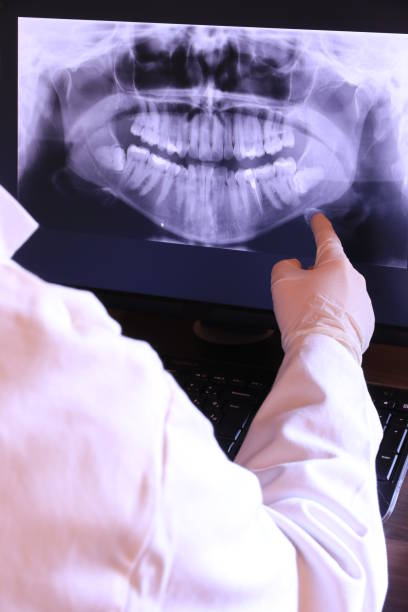 Best Emergency Treatment for Oral Infections in Rice Lake, MN